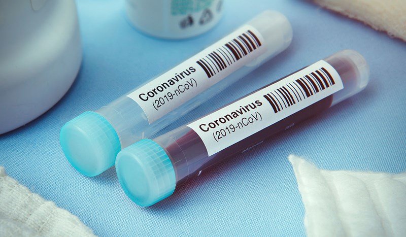 U Hrvatskoj novozaraženih 1186, umrlo deset osoba