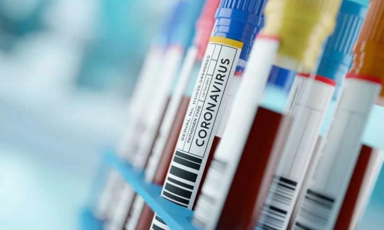 U Srbiji skoro 1.600 novozaraženih, preminulo sedam osoba