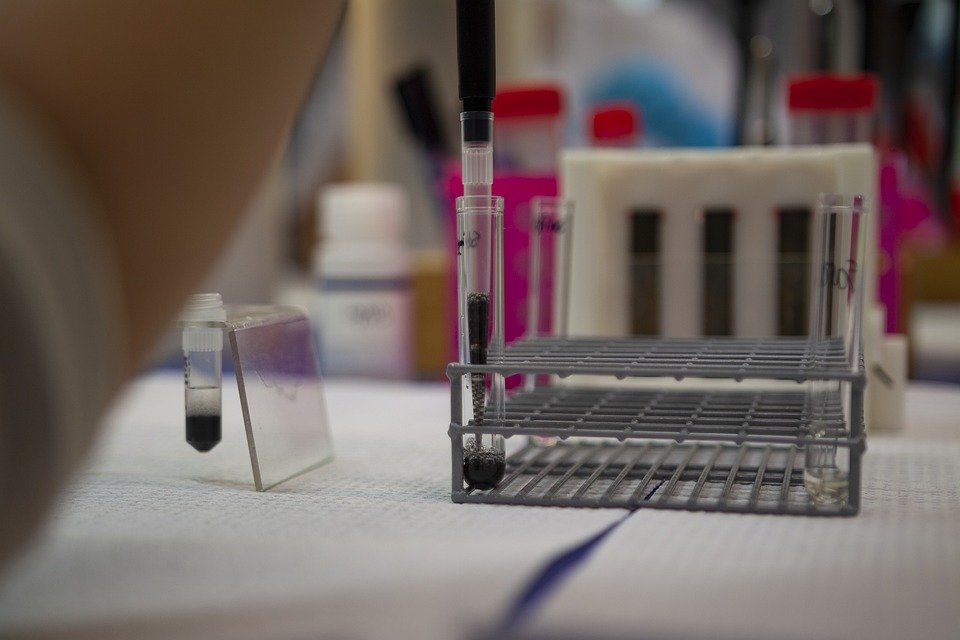 U Srbiji 2.765 novozaraženih, umrlo 27 osoba