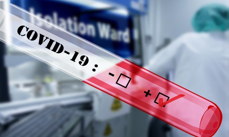 U FBiH 19 novozaraženih, na koronavirus testirana 742 uzorka