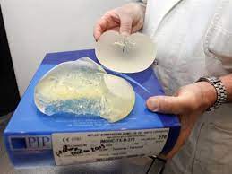 Pariz: Žrtve loših implantata dobijaju nadoknadu