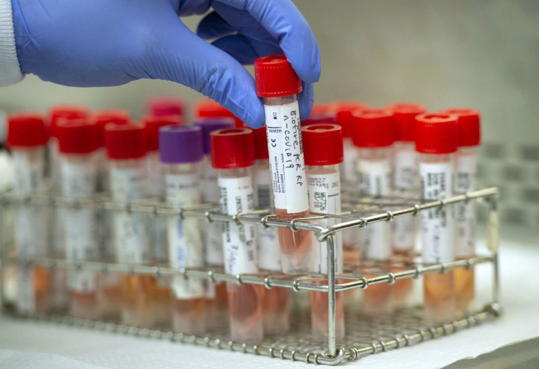 U Srbiji 125 novozaraženih od covida-19, preminule tri osobe