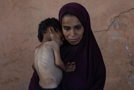 I zvanično u Gazi vlada opća glad