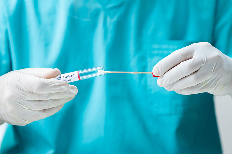 Slovenija: Zaražena 84 lica, jedno preminulo