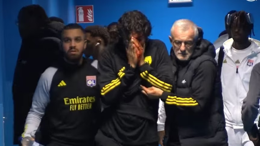 Privedeno devet osoba zbog kamenovanja autobusa fudbalera Liona