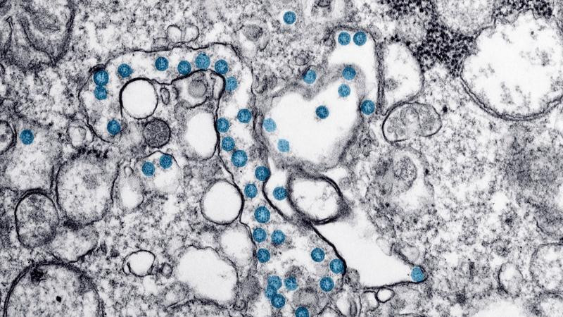 Svjetska zdravstvena organizacija prati novu varijantu koronavirusa EG.5
