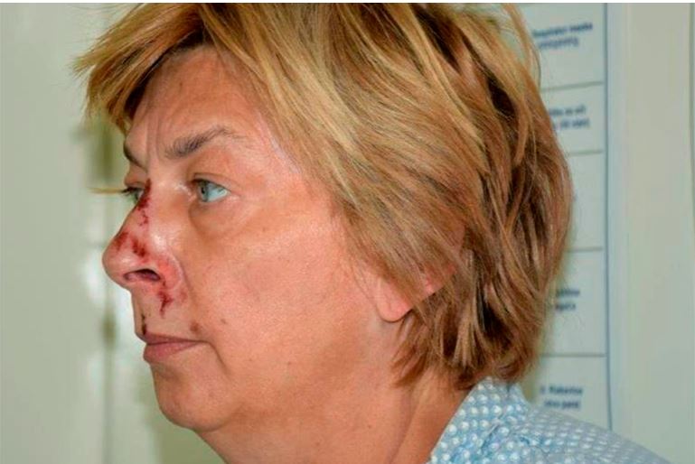 Utvrđen identitet žene pronađene na Krku