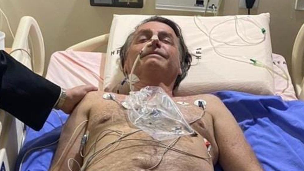 Bolsonaro se oporavlja u bolnici, vjerovatno bez operacije