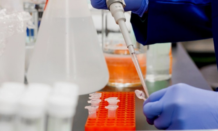 U FBiH u protekla 24 sata 348 osoba pozitivno na SARS-CoV-2