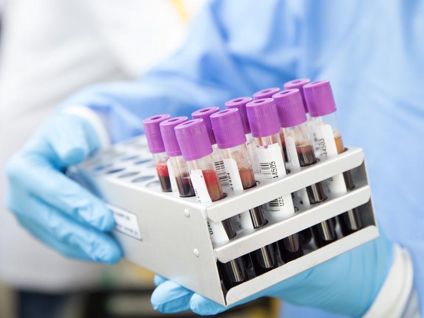 U Crnoj Gori 187 novooboljelih, preminulo dvoje