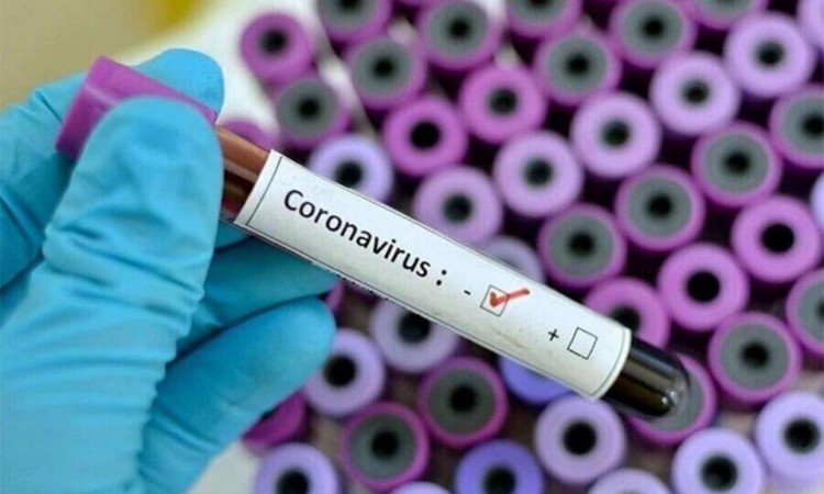 U FBiH 673 novozaražene osobe od 2.570 testiranih uzoraka