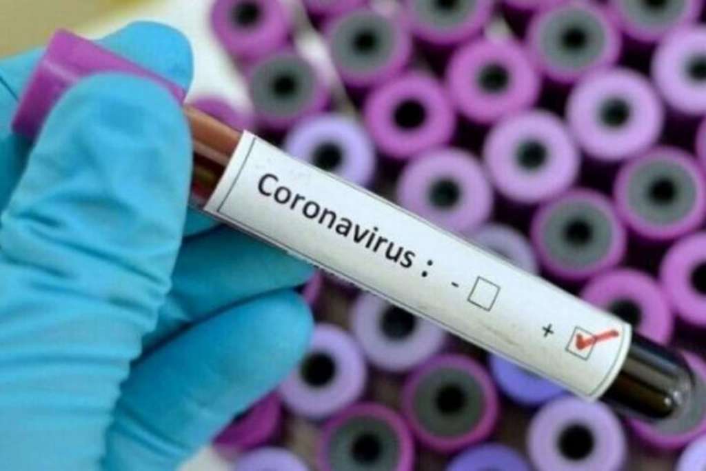 U BiH 149 novozaraženih koronavirusom, preminulo pet osoba