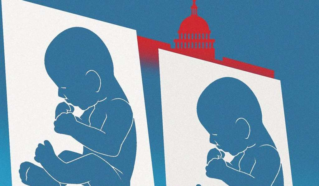 Broj abortusa u SAD-u u porastu, prekida se svaka peta trudnoća