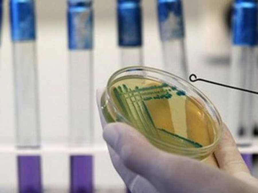 U BiH virus afričke svinjske kuge potvrđen na 560 imanja, eutanazirane 28.784 svinje