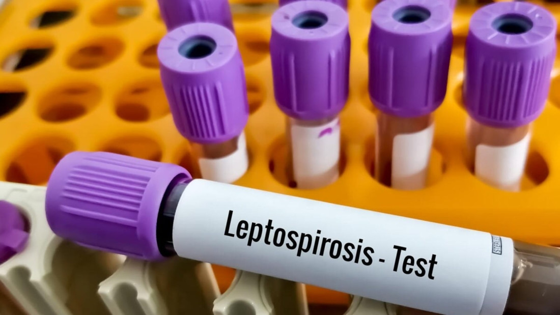 Štab civilne zaštite Općine Novo Sarajevo: Na području općine trenutno nema prijavljenih slučajeva