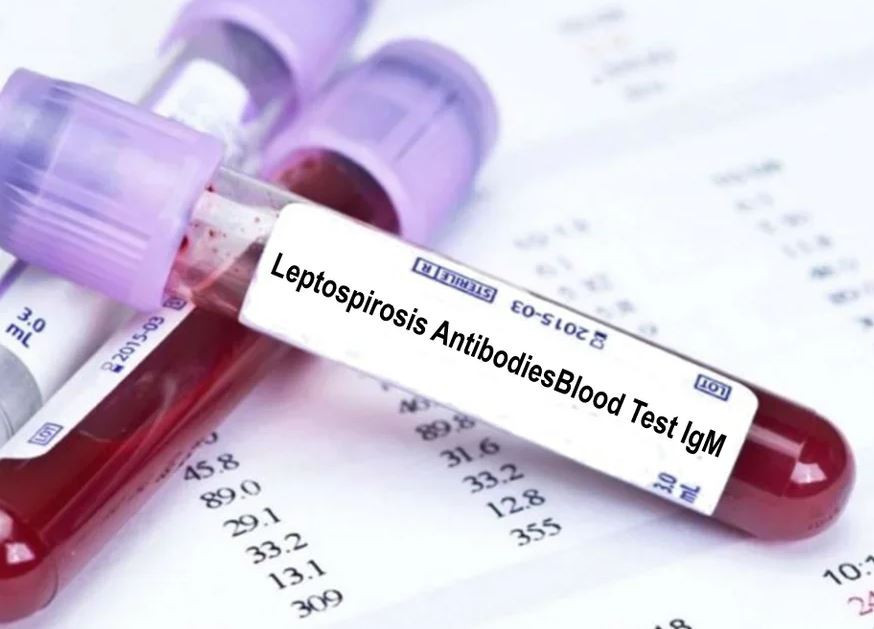 Porastao broj oboljelih od leptospiroze