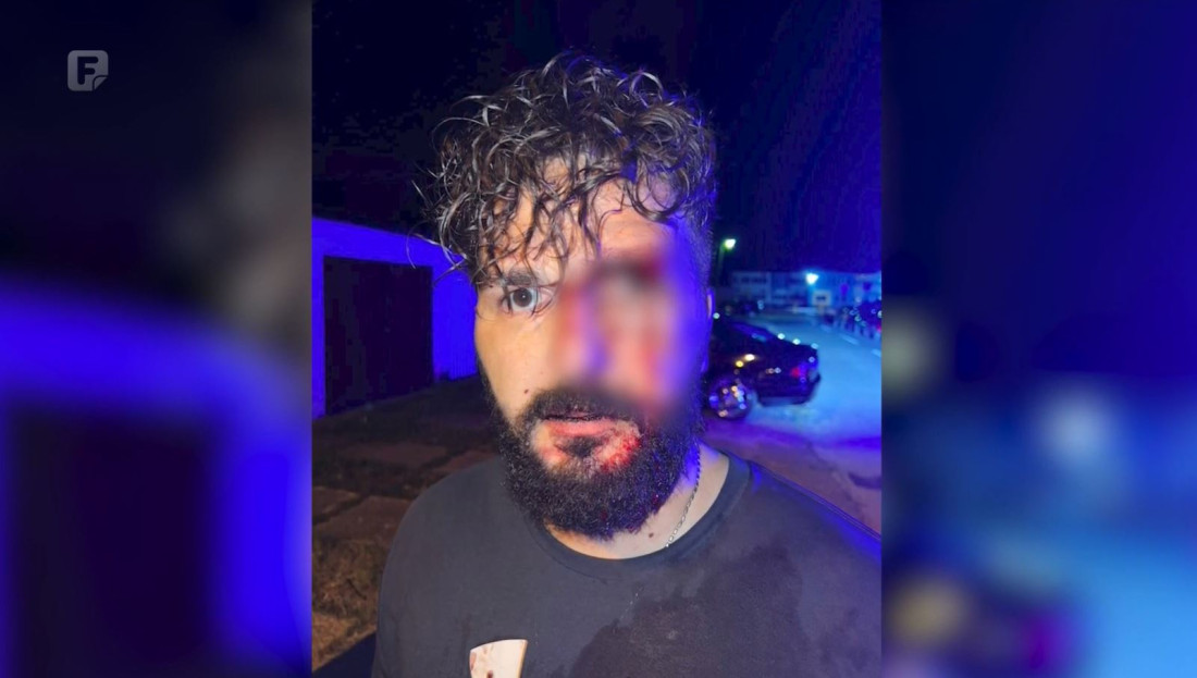 U Brčkom pretučen novinar Mirza Dervišević