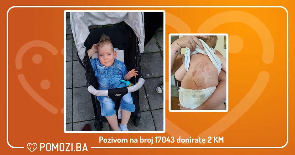 Udruženje Pomozi.ba pokrenulo apel za liječenje malenog Marka