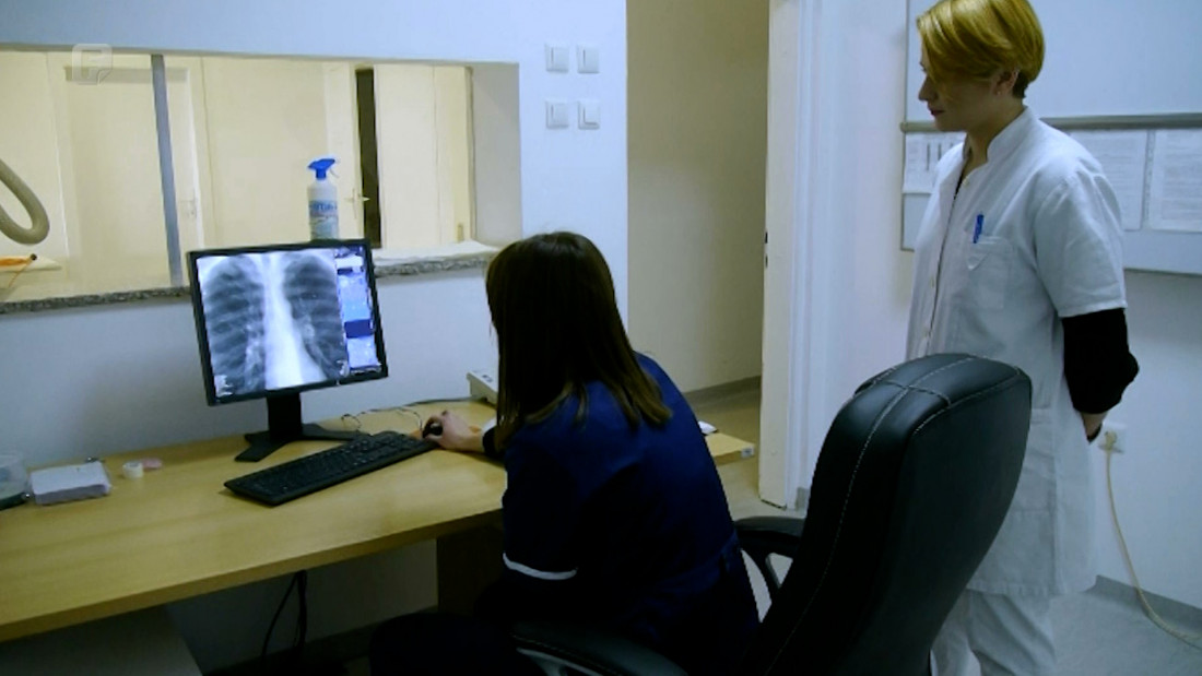 Pandemija covida utjecala i na povećanje broja oboljelih od tuberkuloze