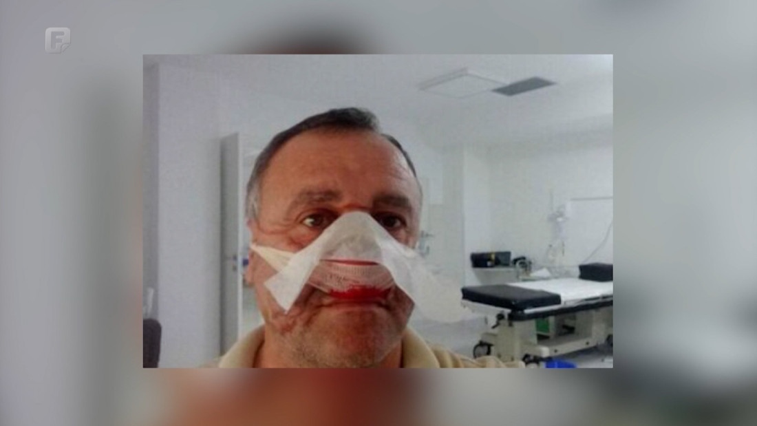 Napetosti uoči lokalnih izbora: Posla ima za policiju, hitnu, vatrogasce…