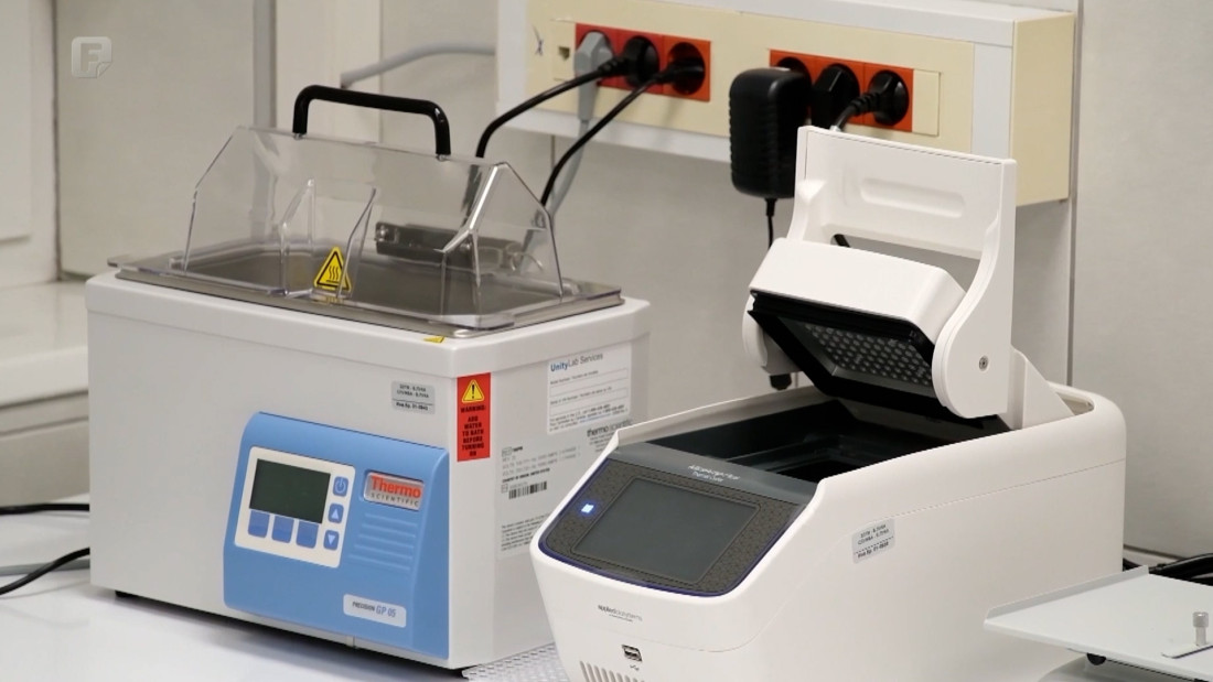 Otvorena laboratorija za HLA tipizaciju tkiva u Banjoj Luci