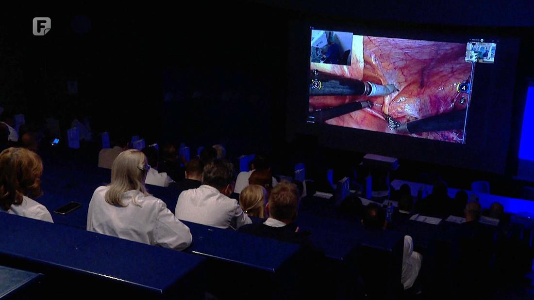 Robotska hirurgija stigla u BiH: Prve operacije na KCUS-u