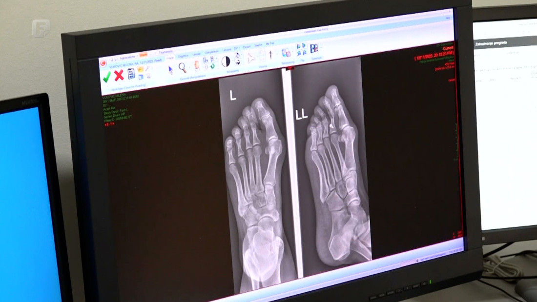 Bijeljinska bolnica počela primjenjivati vještačku inteligenciju u radiologiji
