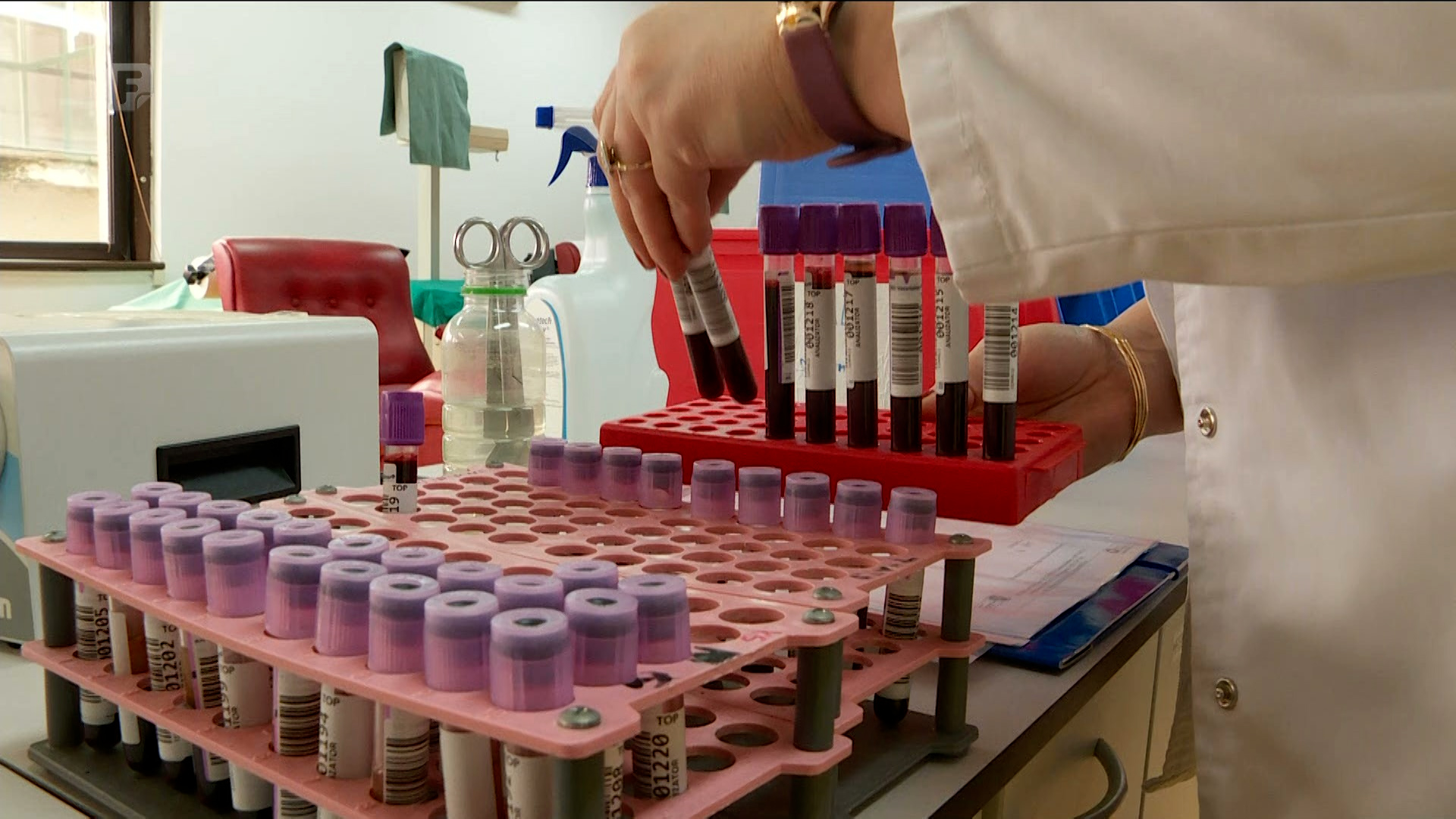 Tačan broj oboljelih od karcinoma u SBK-u se ne zna