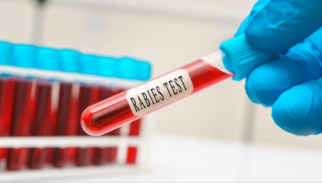 Novi Zeland potvrdio prvi slučaj bjesnila u zemlji, pacijent preminuo