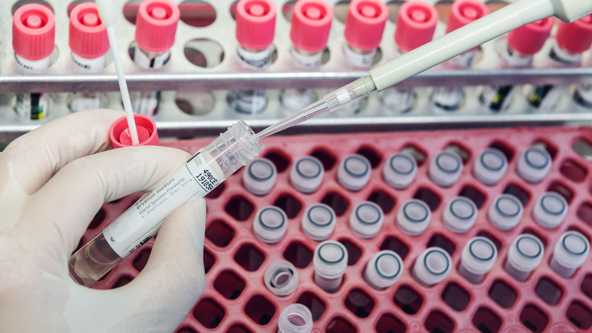 Hrvatska: Zaraženo 186 ljudi