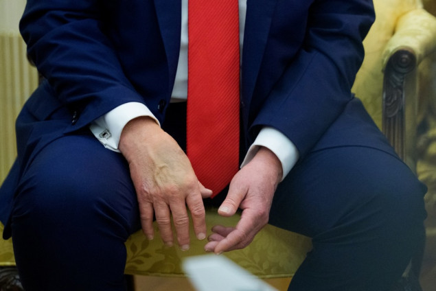 Trumpov doktor tvrdi da su modrice na ruci uzrokovane 'čestim rukovanjem'