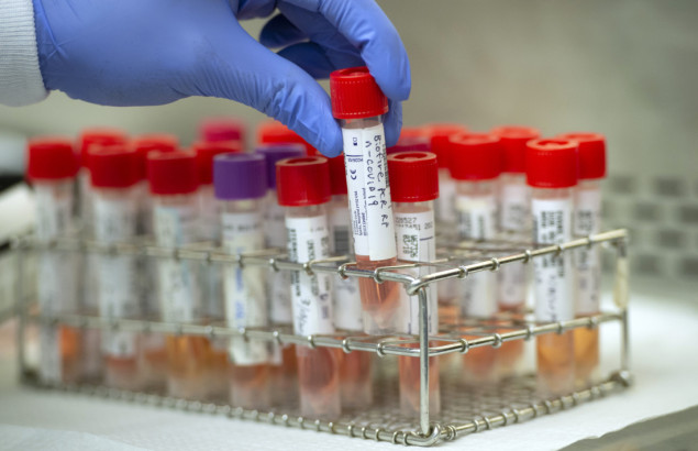 Broj slučajeva Covid-19 u SAD-u premašio 100 miliona