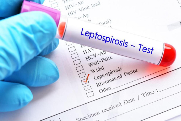 KCUS: Od 11 pregledanih pacijenata s mogućom infekcijom leptospirozom jedan zadržan na liječenju