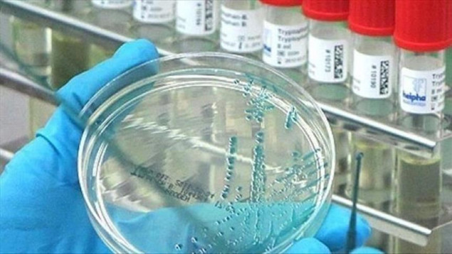 Hrvatska se suočava s dosad najvećim žarištem afričke svinjske kuge, eutanazirat će 10.000 svinja