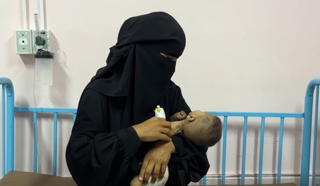 Izgladnjela jednoipogodišnja palestinska beba bori se za život