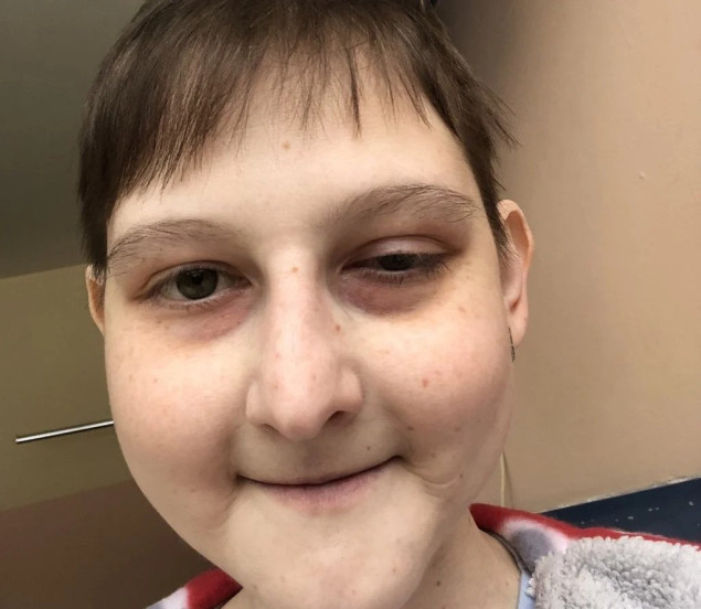 Apel za liječenje 26-godišnje Envere kojoj otkazuju bubrezi i ne vidi