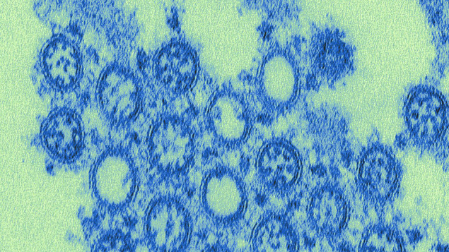 Rusijom hara svinjska gripa