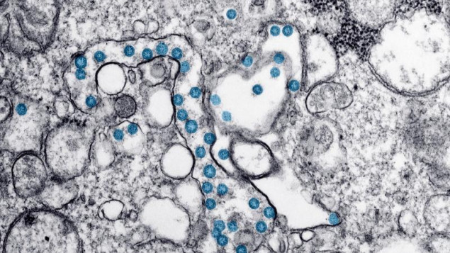 Svjetska zdravstvena organizacija prati novu varijantu koronavirusa EG.5