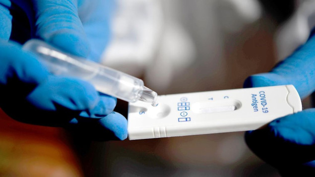 Broj slučajeva COVID-19 u Japanu premašio 30 miliona