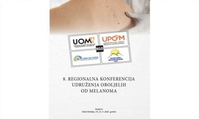 Operta: Na konferenciji o melanomu bit će inicijativa za zabranu solarija, jer je opasan za zdravlje