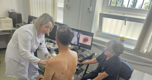 KCUS - Tokom besplatnih dermatoloških pregleda otkriveno pet melanoma