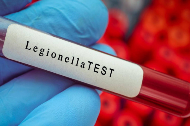 Beroš: Pojava legionele najvjerovatnije zbog radova na vodovodnoj mreži