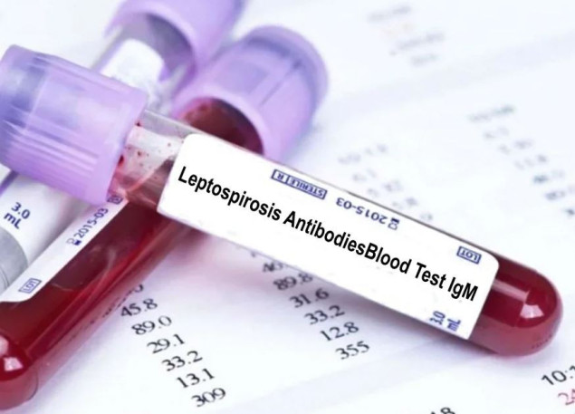 Porastao broj oboljelih od leptospiroze