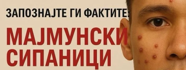U Sjevernoj Makedoniji potvrđena dva slučaja majmunskih boginja