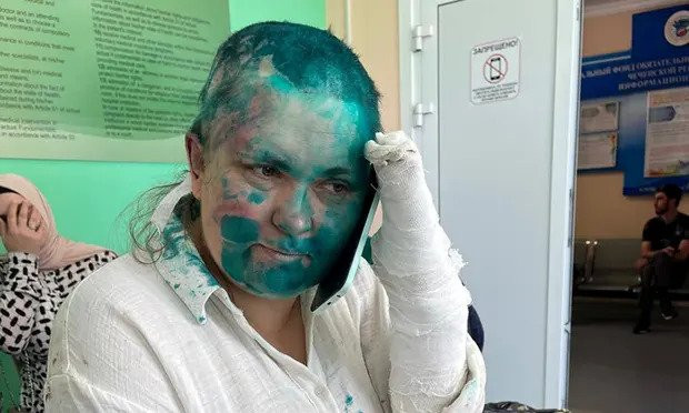 Pretučena novinarka Elena Milashina prebačena u bolnicu u Moskvi