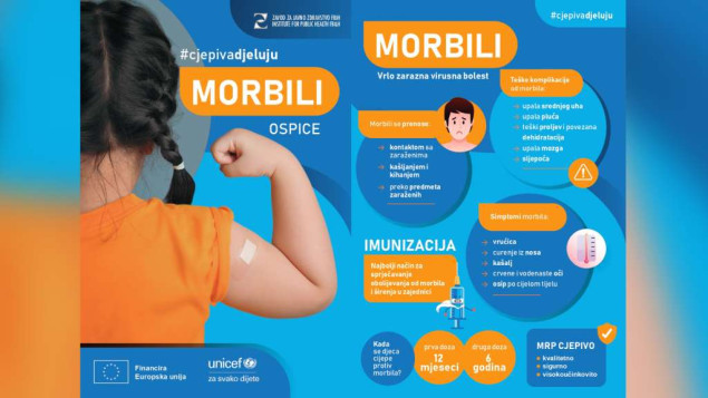 Mladić rođen 2006. godine iz Sarajeva prva žrtva zaraze morbilima