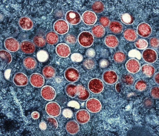 SZO uvodi naziv "mpox" za majmunske boginje