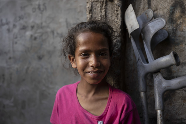 Dvanaestogodišnja Palestinka čeka protezu nakon ranjavanja u izraelskom napadu