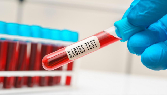 Novi Zeland potvrdio prvi slučaj bjesnila u zemlji, pacijent preminuo