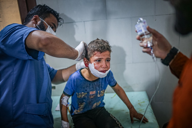 U napadu snaga odanih Assadovom režimu na Idlib ranjeno dvoje djece